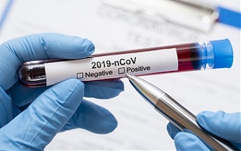 201015_virusLT.jpg